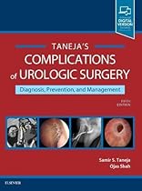 Complications of Urologic Surgery: Prevention and Management, 5e Complications of Urologic Surgery: Prevention and Management, 5e