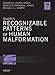 Smith's Recognizable Patterns of Human Malformation