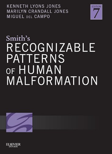 Download Smith's Recognizable Patterns of Human Malformation E-Book (English Edition) PDF