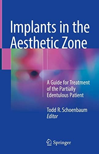 ITI Treatment Guide: Loading Protocols in Implant Dentistry
