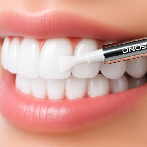ONOSONIC White Teeth Expert® Premium Whitening Gel Pen – Dazzling White Smile in 7 Days | Up to 4 Shades Whiter | Teeth Whitening Pen | clinically approved by dentist