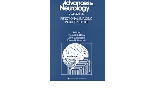 Functional Imaging In The Epilepsies 9780781722667 Medicine