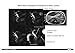 MRI Clinical Handbook: How To Scan MRI Exams