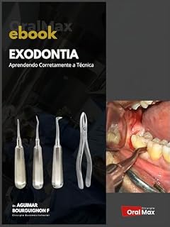 Livro Exodontia. Aprendendo Corretamente a Técnica