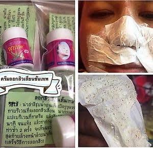 pimple and open pores cream