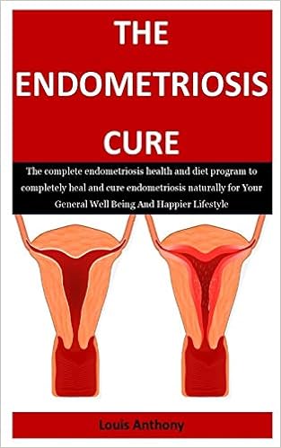 The Endometriosis Cure The Complete Endometriosis Health And Diet Program To Completely Heal And Cure Endometriosis Naturally For Your General Well Being And Happier Lifestyle Anthony Dr Louis 9781705590188 Amazon Com Books