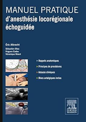 Manuel Pratique D Anesthesie Locoregionale Echoguidee Hors Collection Albrecht Eric Bloc Sebastien Cadas Hugues Moret Veronique 9782294716041 Amazon Com Books