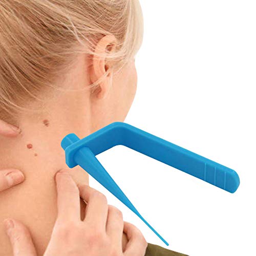 Premium Skin Tag Remover Device – Skin Tag Removal Kit Remove Medium to Large Skin Tags