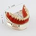 Dental Teaching Model Overdenture Inferior with 4 Implants Demo #6003