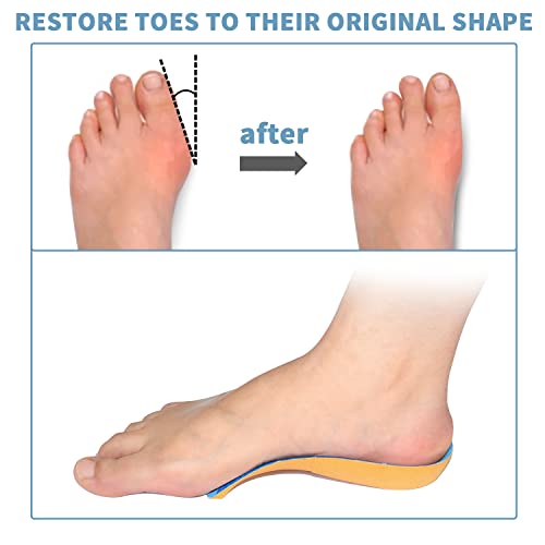 Orthotic Insert Plantar Fasciitis Insoles 3/4 Arch Support Insoles
