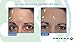Omiera Anti Wrinkle Cream, Dark Spots Corrector, Acne Treatment, Hair Inhibitor, Dark Circles Under Eyes Treatment, Hair Growth Inhibitor, Eyelash Growth Serum Anti-Aging Skin Care Set