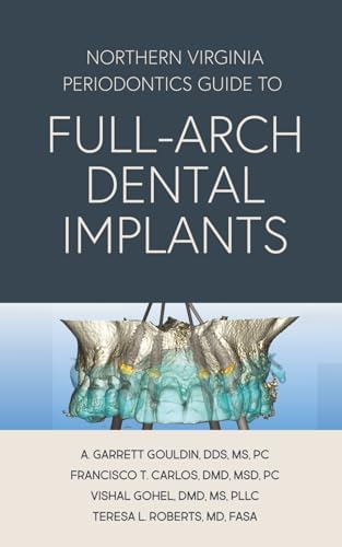 ITI Treatment Guide: Loading Protocols in Implant Dentistry