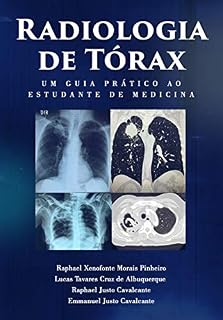 Radiologia de Tórax : um guia ao estudante de medicina
