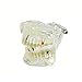 ZJKC Transparent Dental Implant Disease Teeth Model Dentist Standard Pathological Removable Tooth Teaching Tools