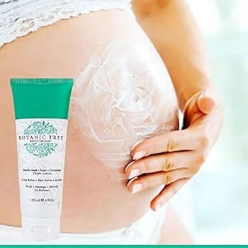 stretch marks cream for girl