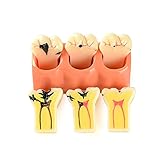 Easyinsmile 4 Times New Dental teeth model Patient Education Model Caries Disassembling tooth model
