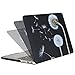 MOSISO Plastic Pattern Hard Case Only Compatible MacBook Pro (W/O USB-C) Retina 13 Inch (A1502/A1425)(W/O CD-ROM) Release 2015/2014/2013/end 2012 & Keyboard Cover & Screen Protector, Black Dandelion