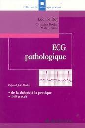 ECG pathologique