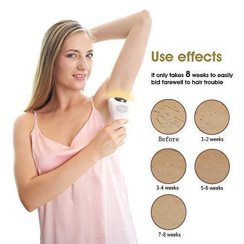 IPL Permanent Hair Removal for Women (500000 Flashes) - Painless - Skin Sensor - Laser Hair Removal Devices for Women Home Use, Remove hair for Face & Body & Bikini