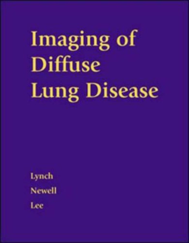 IMAGING OF DIFFUSE LUNG DISEASE