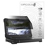 Celicious Privacy Lite 2-Way Anti-Glare Anti-Spy