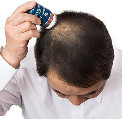 Amazon アートミクロン パウダー シャンプーで洗い流しok ナチュラルブラック 単品 g 白髪 ボリューム感 時短 アートネイチャー アートミクロン 増毛 ボリュームアップスプレー 通販