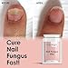 NAIL BRIGHT PILLS - FUNGUS TREATMENT STOP NAIL DISCOLOURATION STOP BACTERIA