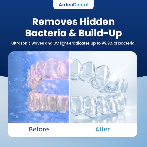 Ultrasonic Retainer Cleaner with UV-C Light for Aligners, Retainers, Dentures & Mouthguards – Daily Deep Cleaning Dental Appliance Machine Portable, Easy to Use at Home & Travel