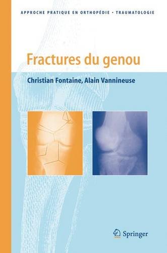 Fractures du genou