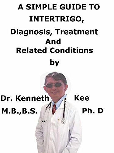A  Simple  Guide  To  Intertrigo,  Diagnosis, Treatment  And  Related Conditions (A Simple Guide to Medical Conditions)