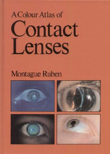A Colour Atlas of Contact Lenses and Prosthetics Hardcover – June 25, 1982