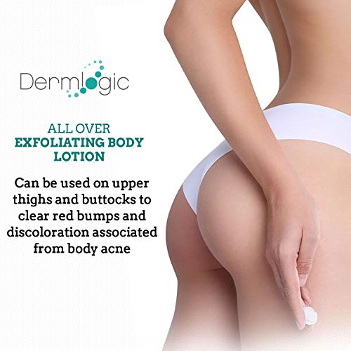 Keratosis Pilaris Treatment Get Rid of KP, Bumps & Body Acne. 12