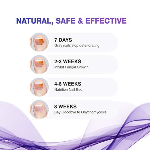 3 GoPro+GHDS30+Head+Strap+Mount