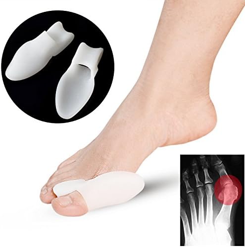 Novadeal Pack of 2 Toe Separator, Soft Gel Toe Realignment Spacers ,Toe Protector, Spreader, Straightener For Walking
