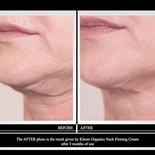 Kleem Neck Firming Cream for Sagging Skin - Anti Aging Neck Cream with Retinol & Panthenol - Firming Neck & Décolleté Cream that Improves Elasticity, Smooths Fine Lines & Wrinkles - 50ml
