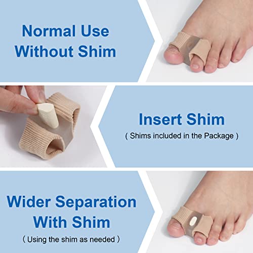 BIGGCOOL Bunion Corrector Toe Separators for Overlapping Toes, 2 Loops Toe Spacers For Feet Women and Men(2 PCS Toe Corrector + 4 PCS Shims)