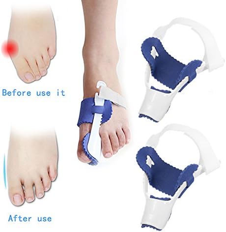 Bunion Corrector&amp;Bunion Relief Protector,1 Pair Splint Hallux Valgus Big Toe Orthotics Device,Toe Separators Spacers Straighteners for Men&amp;Woman