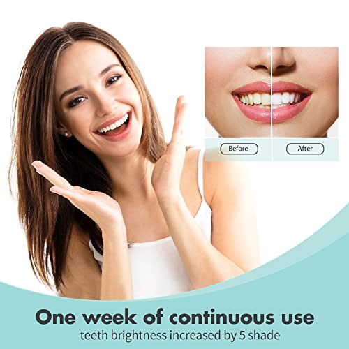 TIEBOW Teeth Whitening,3X Gel Syringes&Whitening Pen with Professional 35% Carbamide Peroxide Teeth Whitener,16X Teeth LED Light Accelerate whitening,Pain Free and Enamel Safe Teeth Whitening Kit