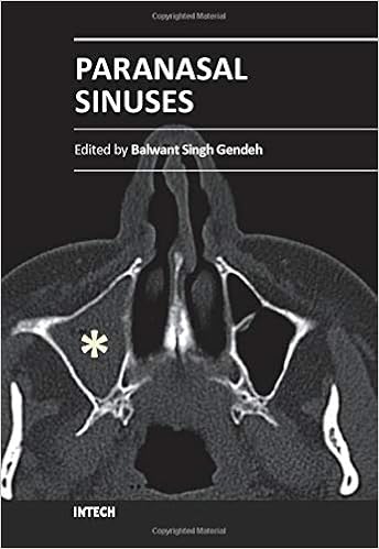 Paranasal Sinuses Medicine Health Science Books Amazon Com Paranasal Sinuses Medicine Health Science Books Amazon Com