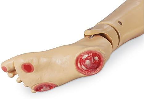 Pressure Ulcer Foot for GERI/KERI