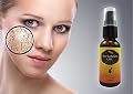 Sea Buckthorn Oil From Skinzeal â˜… 100% Pure and Cold Pressed â˜… Acne Prevention & Healing â˜… Rosacea Prevention & Relief