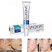Anti Acne Removal Cream,Kemilove Effective Face Skin Care Removal Cream Acne Spots Scar Blemish Marks Treatment