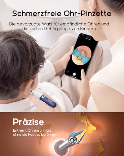 BEBIRD Earsight Plus R37R Kit De Ferramentas Para Limpeza e Remoção De Cera Do Ouvido, Câmera Otoscópica Flexível Com Luz, Pinça Sem Fio Para Remoção De Cera Do Ouvido (Azul)