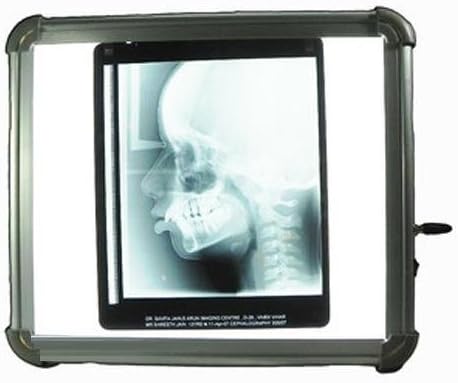 Medical Sensor X-Ray Viewer LED with Warranty 2 years warranty