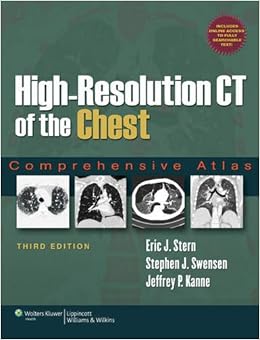 High-Resolution CT of the Chest: Comprehensive Atlas