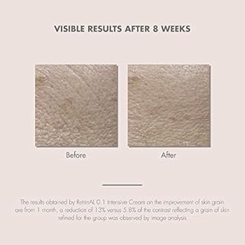 buy avene retrinal 0.1