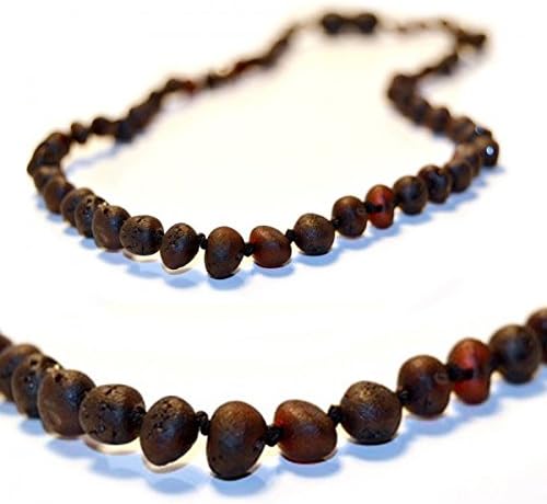 The Art of Cure Baltic Amber Teething Necklace - Raw Cherry