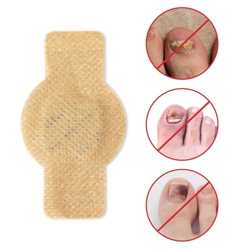 Toenail Repair Patches, Night Care for Thickened, Yellowed or Damaged Nails, Adhesive Nail Patch, Daily Use, 21 Patches