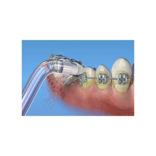Waterpik Dental Water Jet Orthodontic Replacement Tips (Pack of 2