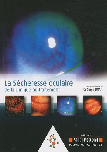 La  sécheresse oculaire